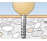 Ограничитель хода двери Fischer TS 8 BG бежевый 10 штук 60551 2
