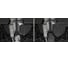 Защита топливного бака АвтоБРОНЯ Hyundai Tucson 15-18/Kia Sportage 16, 111.02358.2 2
