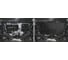 Защита картера и КПП АвтоБроня Mazda 3 BM 13-18/6 GJ 12-18 18-/CX-5 11-17 17-/CX-9 16-, 111.03825.1 3