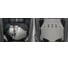 Защита картера и КПП Rival для Acura MDX III V - 3.5 2014-2016/Honda Pilot III V - 3.0 2016-2019 333.0101.1 3