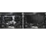 Защита картера + КПП + комплект крепежа AutoMax сталь, Mazda 6 2018-, V - 2.0; 2.5/Mazda 3 2013-, V - 1.5; 1.6; 2.0/Mazda 6 2015-2018, V - 2.0; 2.5/ AM.3825.1 3