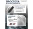 Съемник двух-трехзахватный переставной Rockforce 16" Øзахвата 65-400мм, глубина захвата 315мм, длина лап 400мм, ширина лап 25мм, лапы S-образные RF-6590616(17185) 3