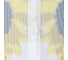 Противомоскитная сетка Rosenberg 80x220см R-400031 5
