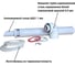 Дымоход коаксиальный с наконечником антилед 60/100 мм + protherm bosh buderus baxi 750 мм Прок ПР782990 4